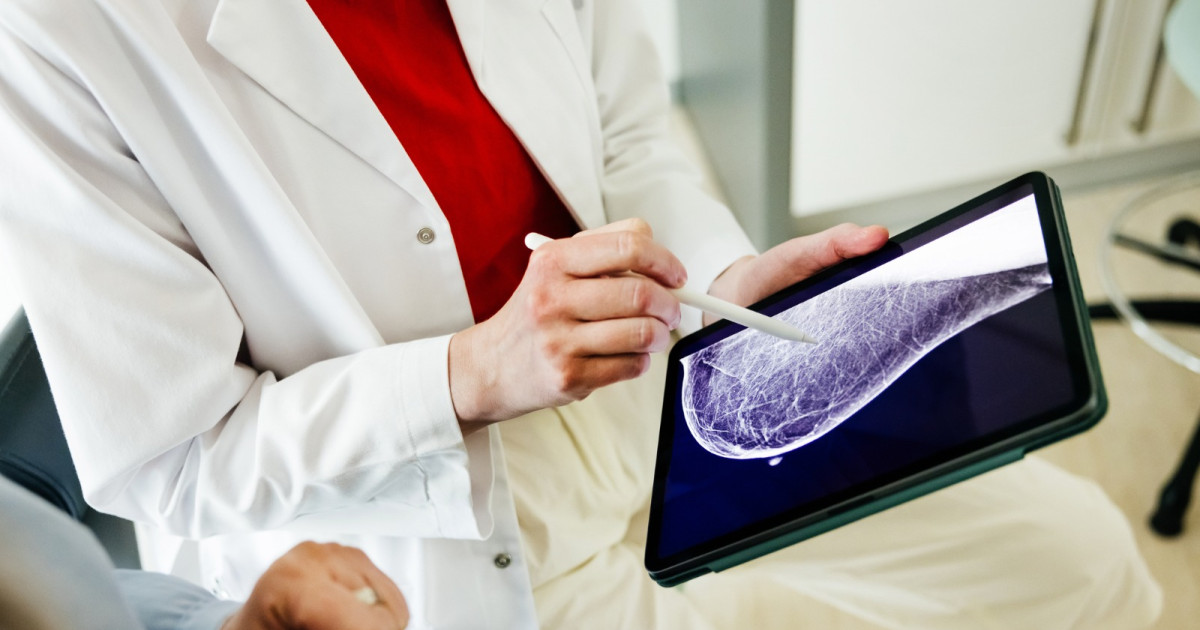 Medicament pentru oprirea lactației ar putea reduce riscul de cancer de sân cu 69%