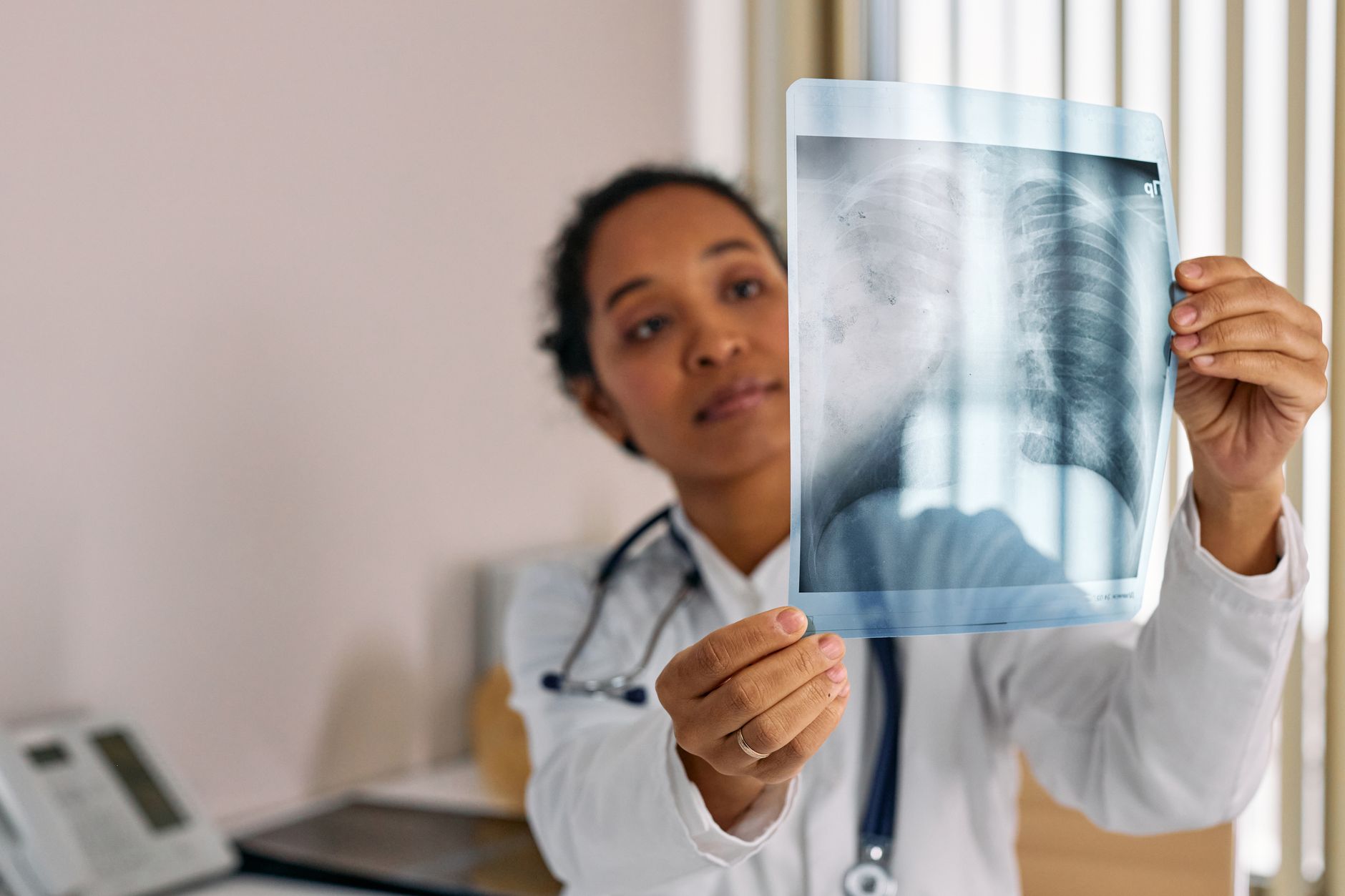 Cancerul pulmonar poate fi detectat fără simptome prin screening anual cu CT cu doză redusă