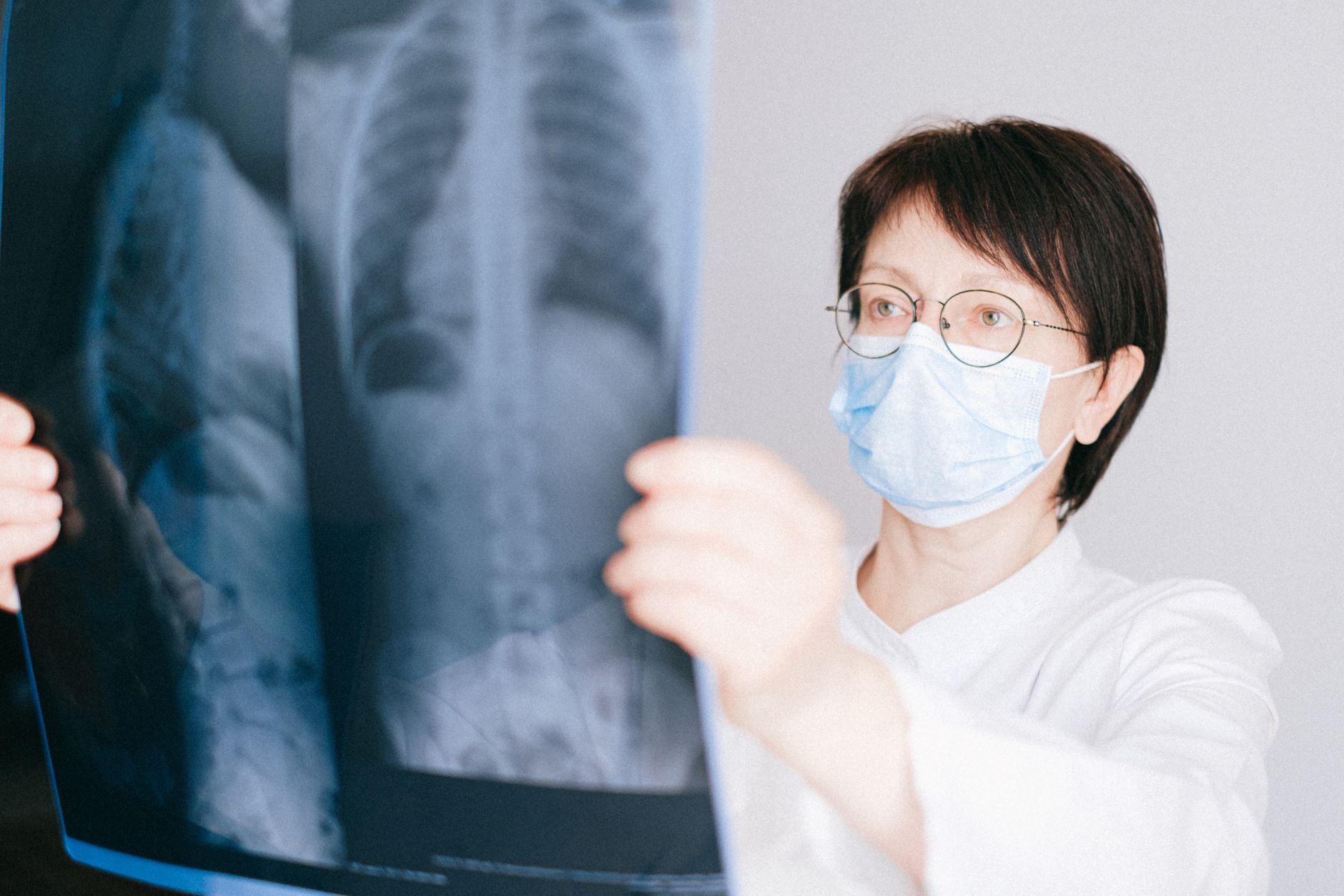 Tehnologie AI revoluționară: un selfie poate prezice șansele de supraviețuire ale pacienților cu cancer