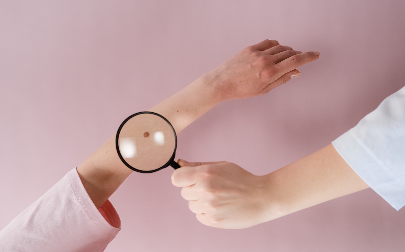 Succes clinic pentru vaccinul personalizat împotriva cancerului: riscul de recidivă scade cu 42%