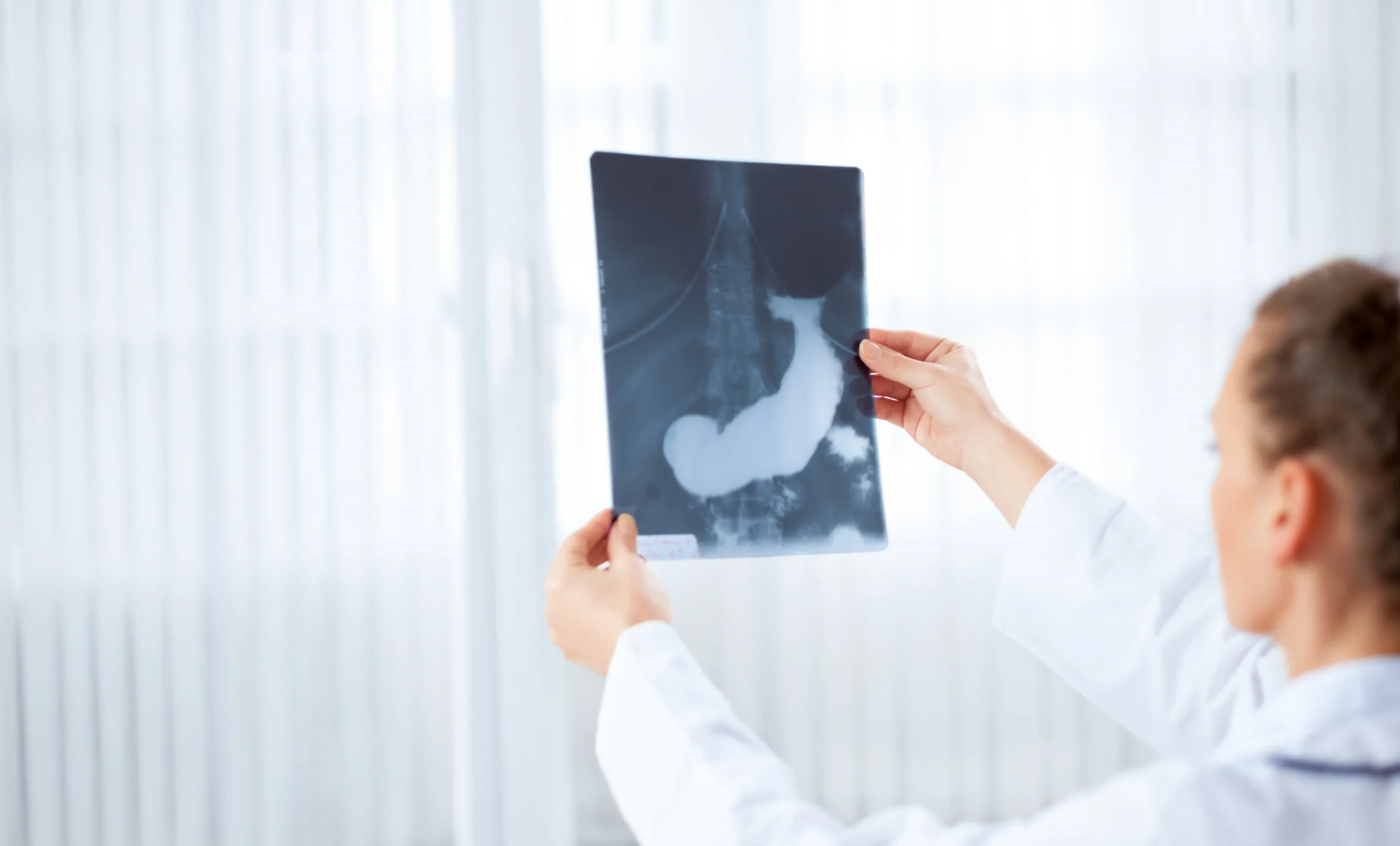 Cancerul de pancreas în România: diagnosticul precoce și expertiza chirurgicală sunt vitale