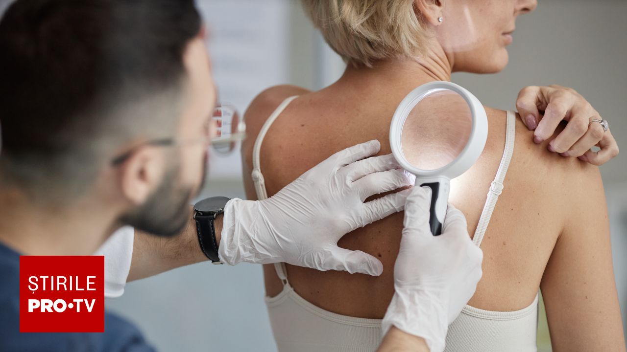 Un nou vaccin personalizat reduce cu 42% riscul de deces în cazul melanomului agresiv