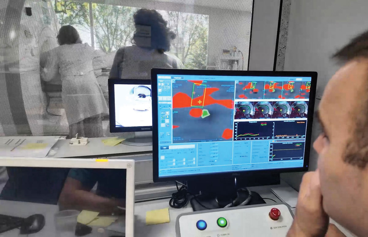 Neurochirurgia fără bisturiu: Tehnologia Exablate Neuro tratează tremorul esențial prin ultrasunete