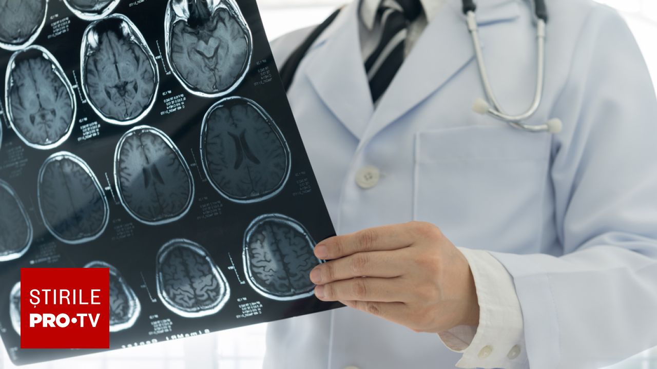 Criza recuperării după AVC: Doar 30% dintre pacienți beneficiază de neuroreabilitare în secțiile de neurologie