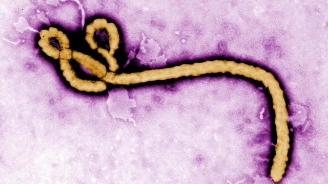 Epidemia de Ebola din RD Congo devine cea mai de amplă și mortală din istoria țării