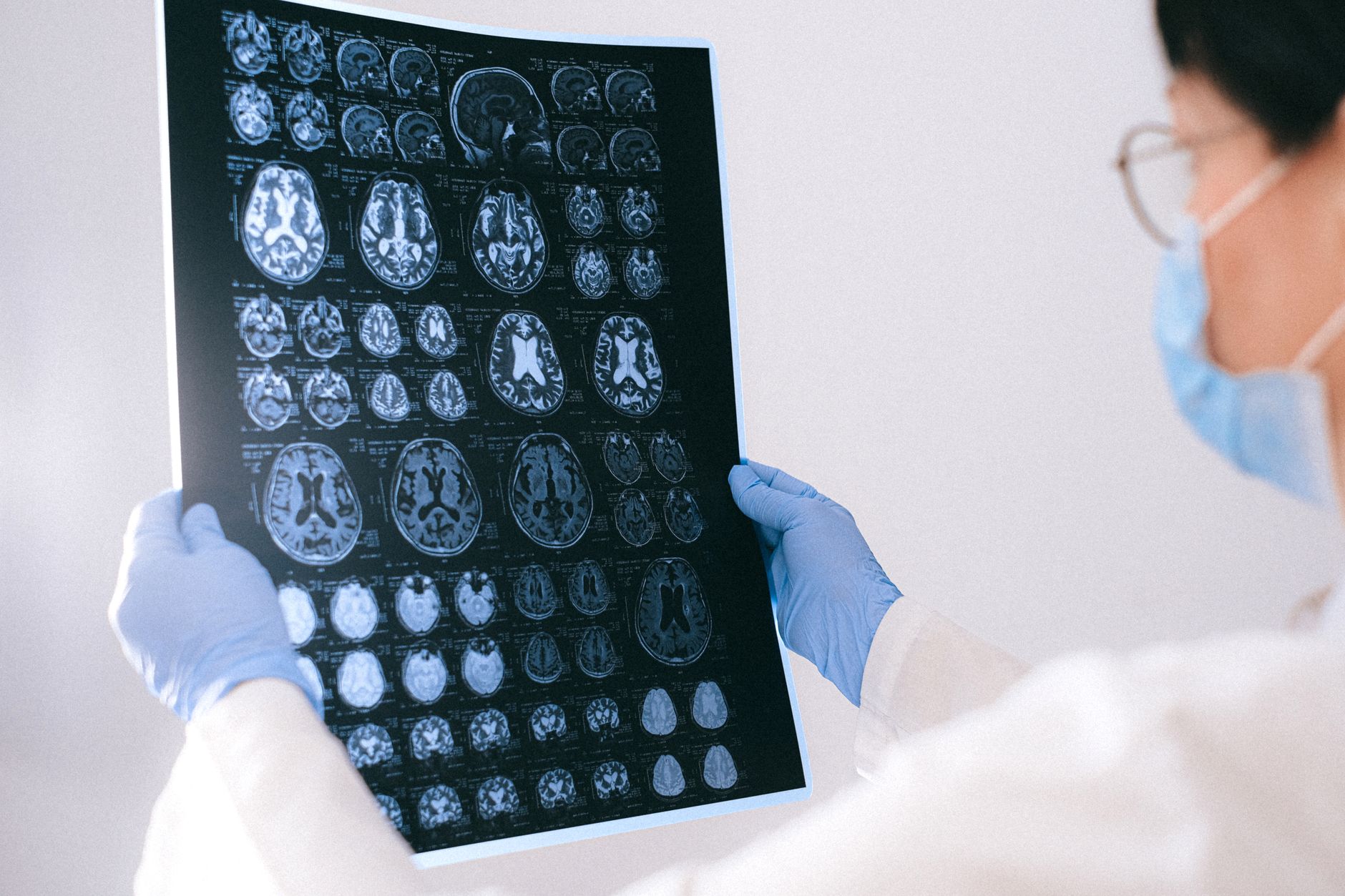Criza demenței în România: Parteneriat între Eli Lilly and Company și Neuroaxis pentru diagnostic precoce