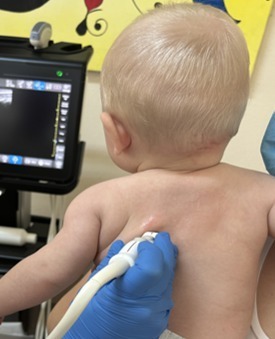 Inteligența artificială în ecografia pulmonară pediatrică: un instrument suplimentar pentru medici, nu un înlocuitor