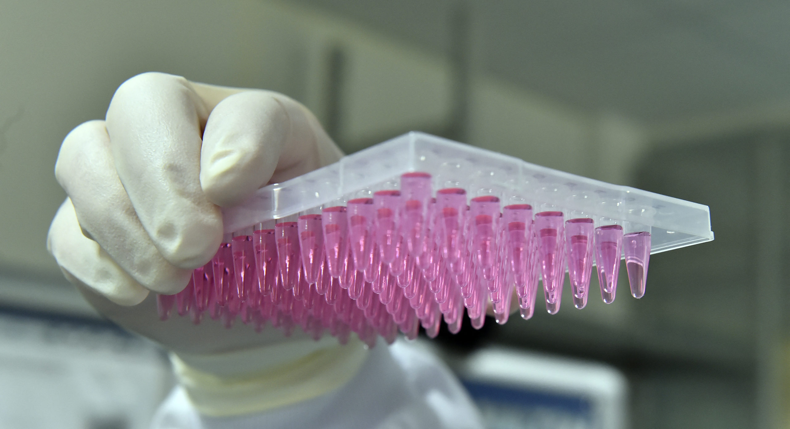 Noua tehnologie genomică din Marea Britanie poate accelera diagnosticarea tumorilor cerebrale