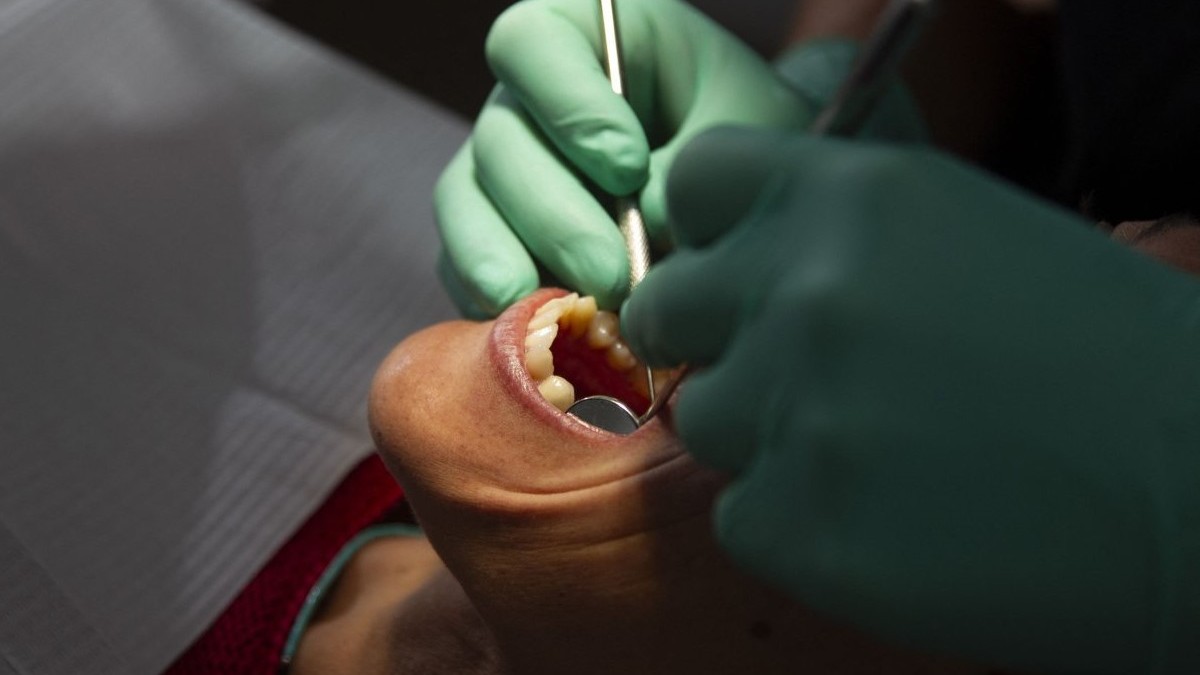 Avertisment medical: O simplă radiografie dentară poate detecta boli precum cancerul sau leucemia