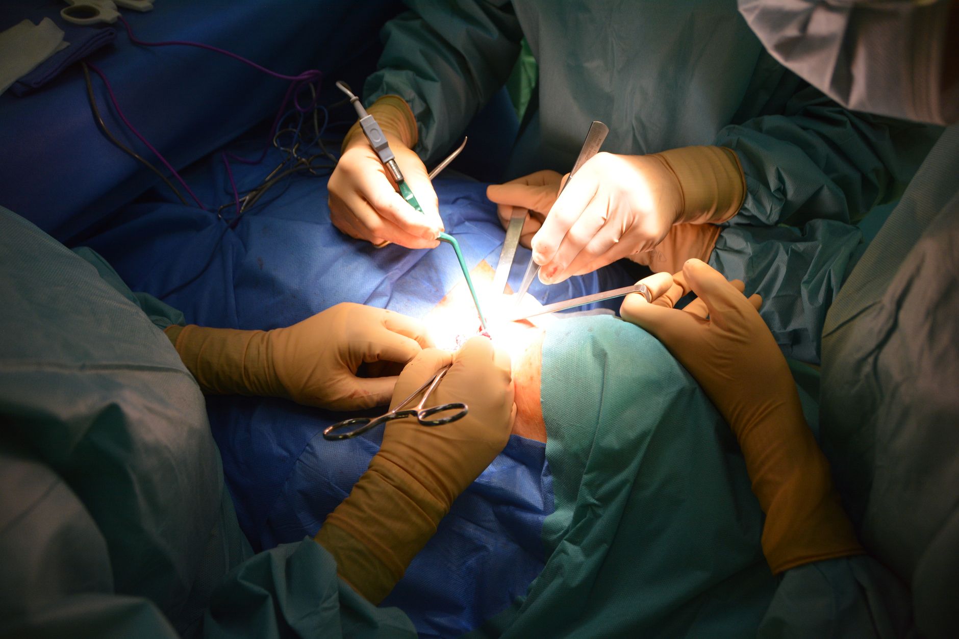 Intervenție cardiacă de excepție la Sibiu: pacient cu anatomie în oglindă a fost salvat prin tehnica TAVI