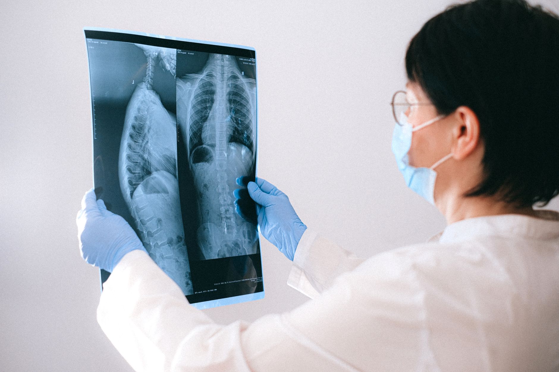 Tehnologia PET-CT PSMA: Cum poate fi monitorizată extinderea cancerului de prostată