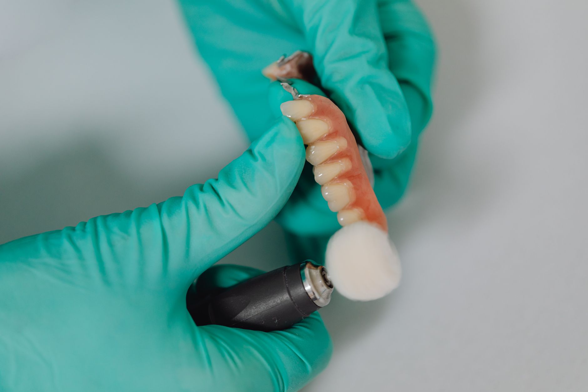 Confuzii în implantologia dentară: Diferențele dintre protocoalele All-on-4 și All-on-6 și impactul asupra costurilor