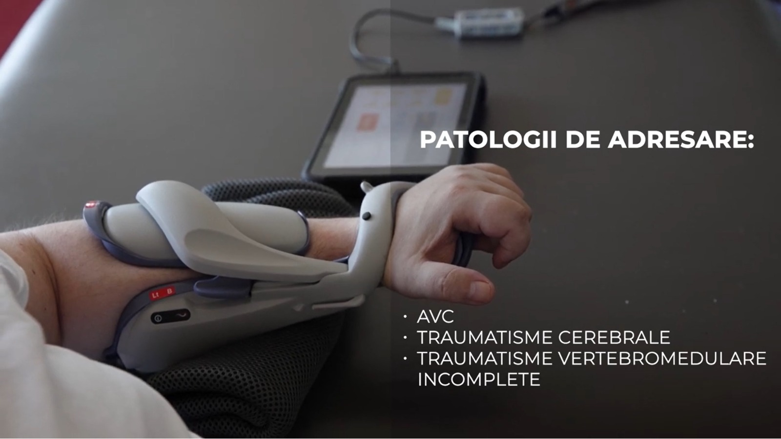 Tehnologie inovatoare în România: Orteza Bioness ajută pacienții cu paralizie după AVC