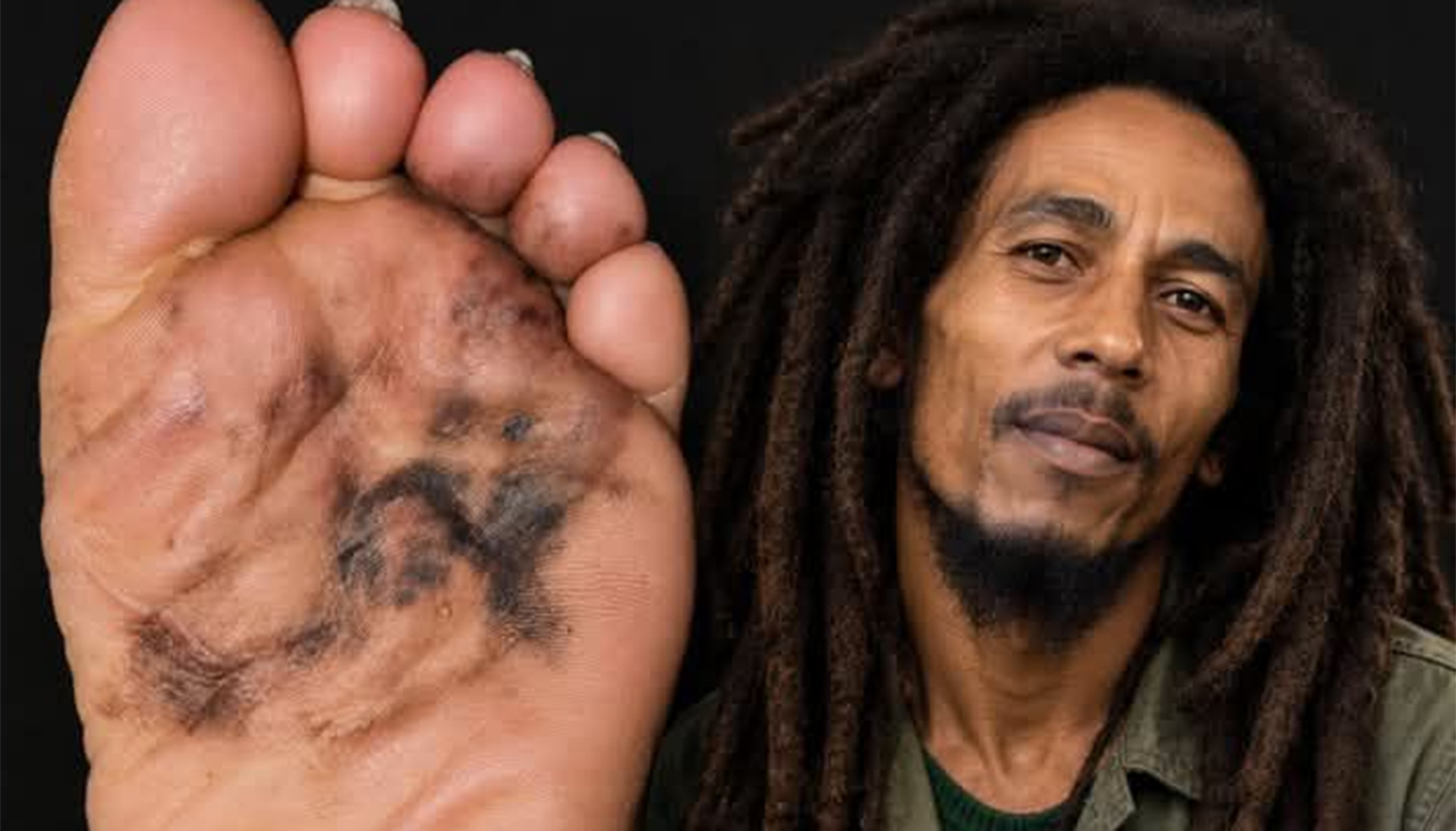 Povestea tragică din spatele morții lui Bob Marley: cum un diagnostic ignorat a dus la sfârșitul muzicianului
