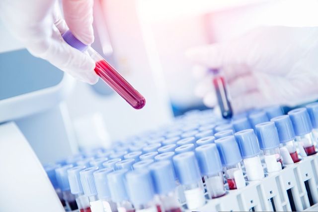 Inteligența artificială poate identifica semnele îmbătrânirii celulelor stem pentru tratamente de întinerire