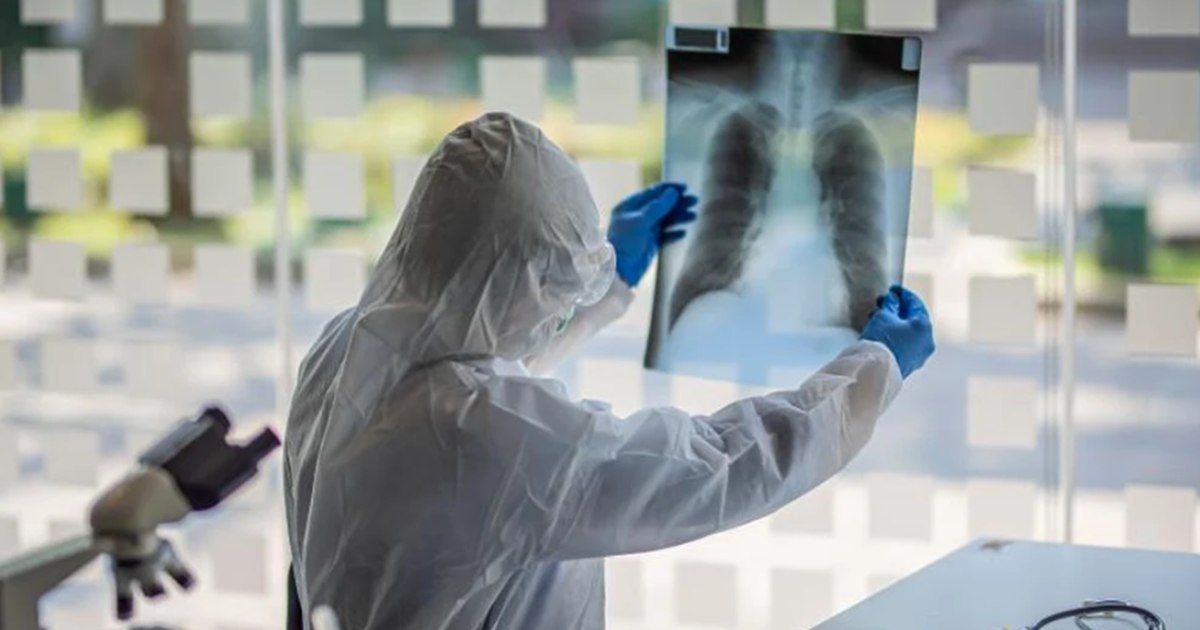 Nodulul pulmonar: ce înseamnă această afecțiune și de ce este cazul Papei Leon al XIV-lea