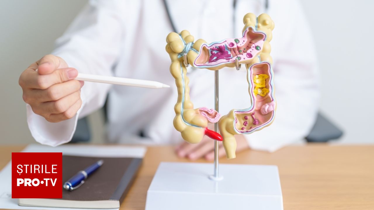 Bărbații sunt expuși unui risc mai mare de cancer colorectal din cauza grăsimii viscerale